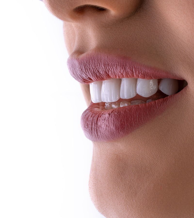 Sonrisa diseñada