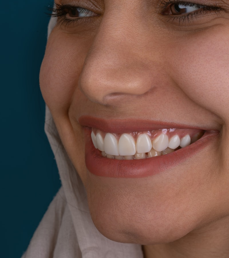 Sonrisa estética