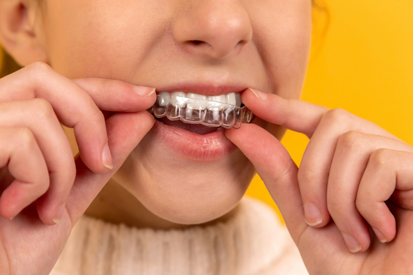 Estetica dental